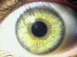 Iridology_2